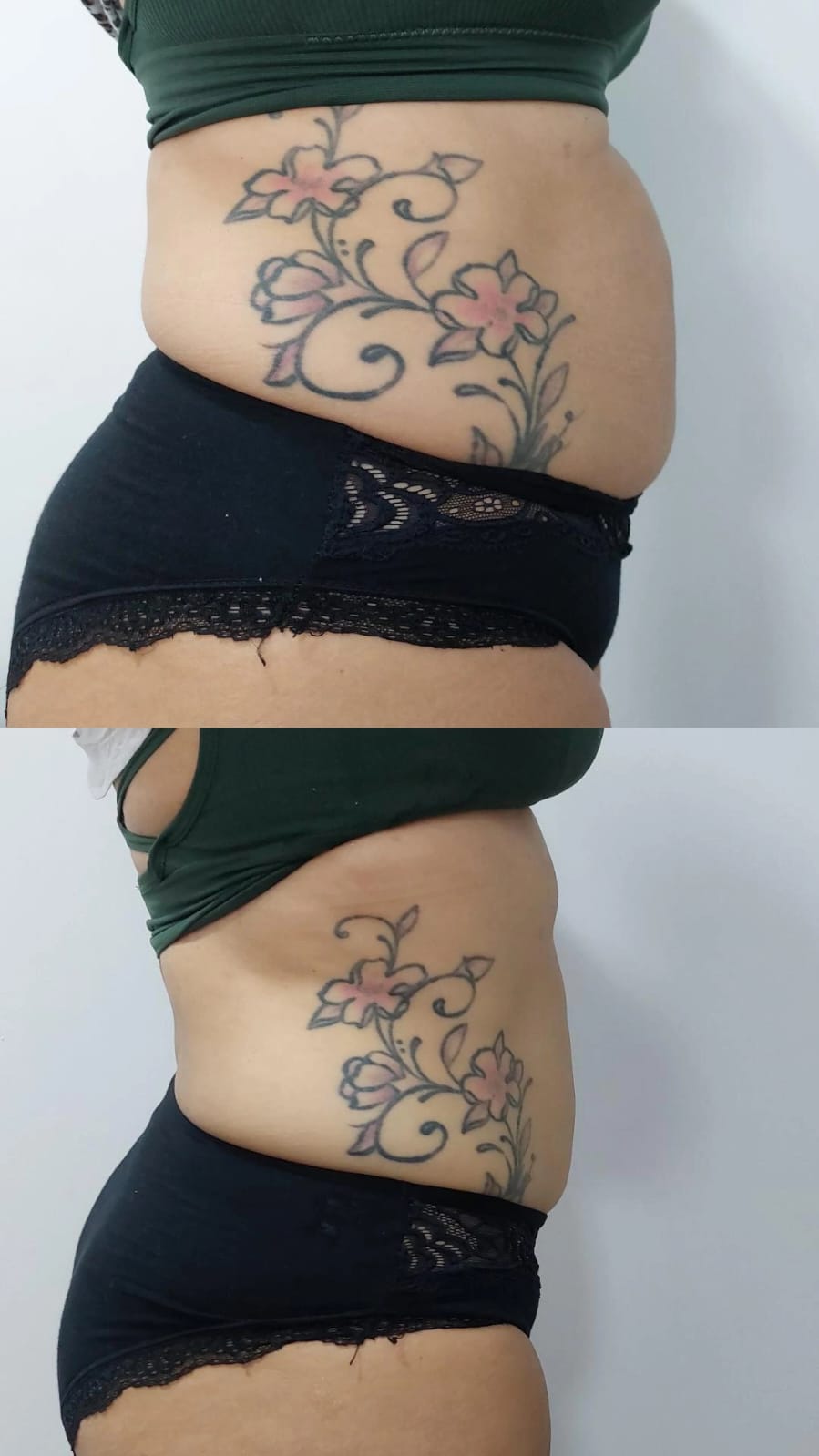 Imagen Antes y Después